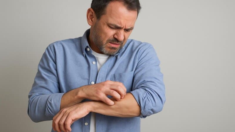 17. Unexplained Itching